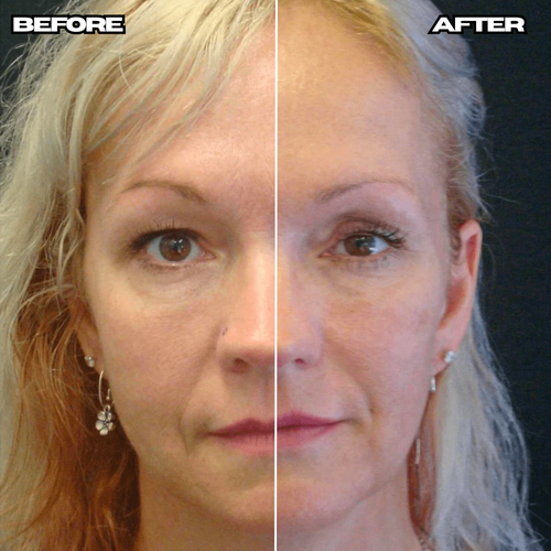 Anti-Wrinkle Age Defense Cream