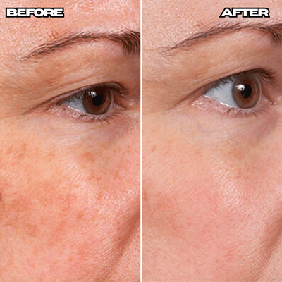 Anti-Wrinkle Age Defense Cream