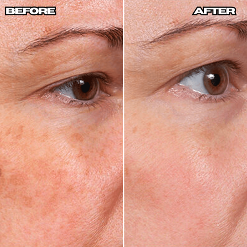 Anti-Wrinkle Age Defense Cream