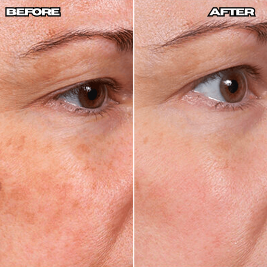 Anti-Wrinkle Age Defense Cream