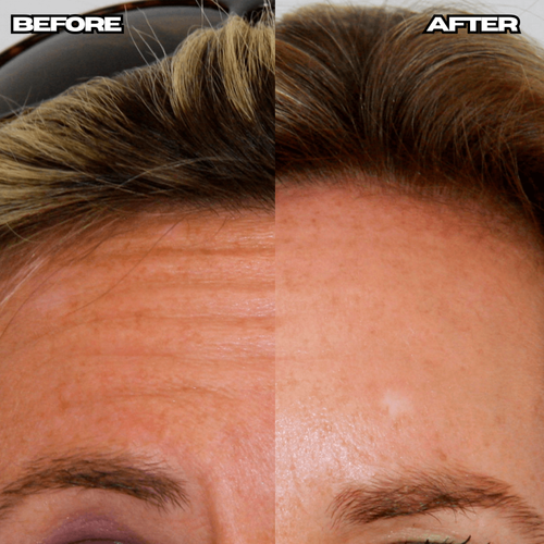Anti-Wrinkle Age Defense Cream